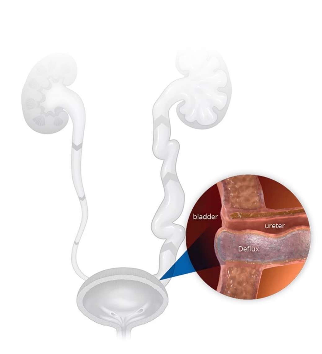 alt-home-image-1-defluxadvantage-2