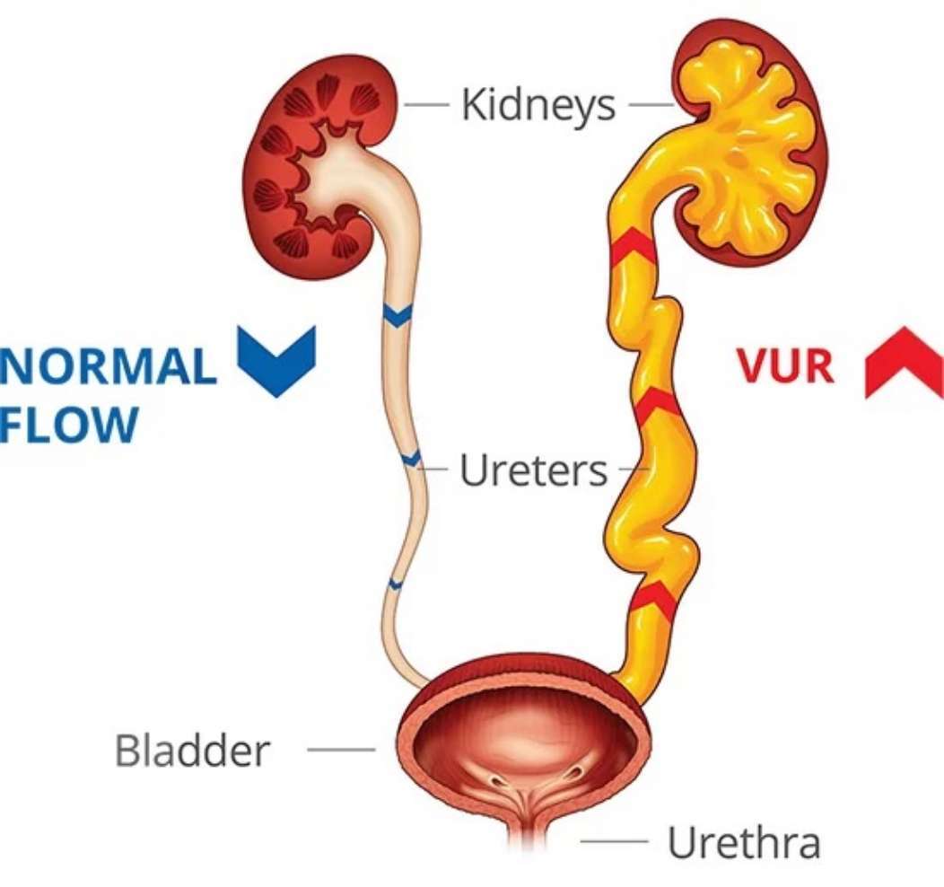 alt-home-image-whatisvur